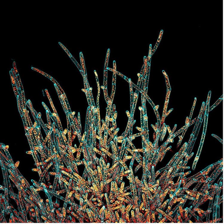 Microscope deconvolved Z-stack image of moss Physcomitrium patens protonemal cells