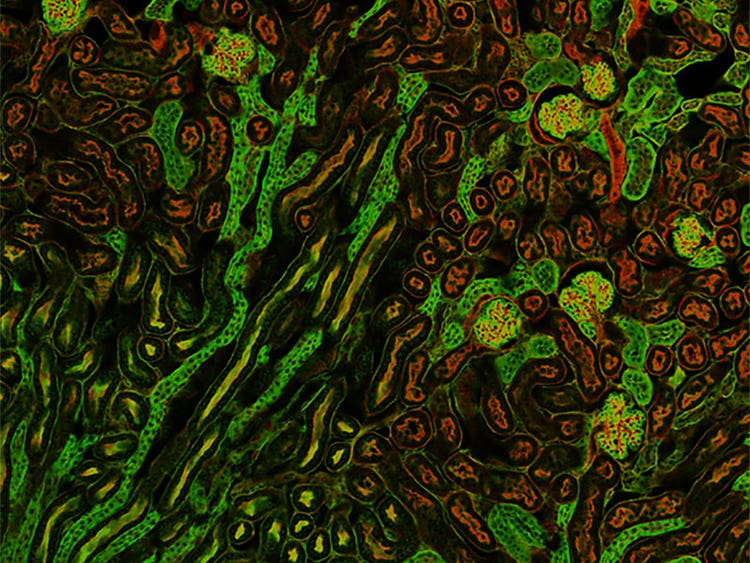Prediction of glomeruli positions on a mouse kidney section using TruAI (blue).