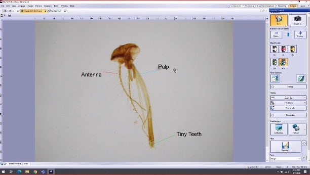 Remote learning using a microscope camera