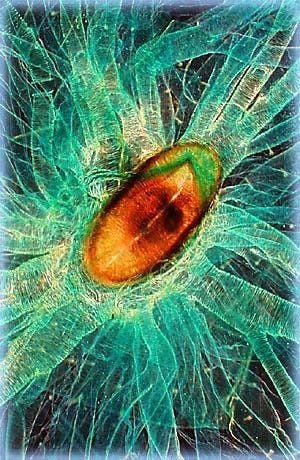 dark field illumination of silkworm larva spiracle and trachea