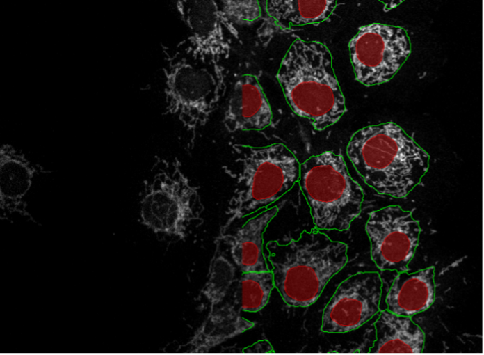 Deep learning image segmentation of COS-7 cells