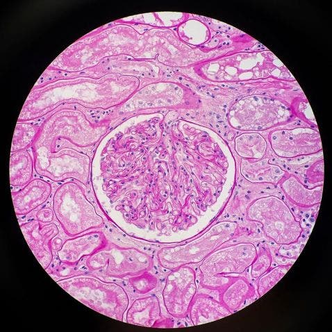 Tiger kidney stained with periodic acid schiff