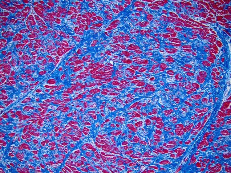 Trichrome stain of heart shown under the microscope