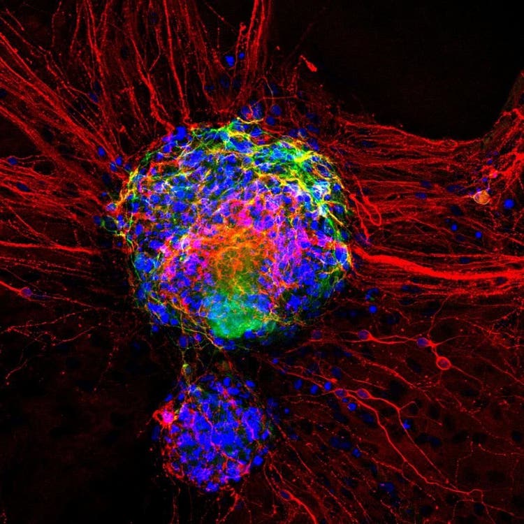 dopaminergic neurons