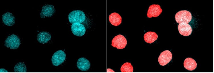 Segmentation of touching nuclei