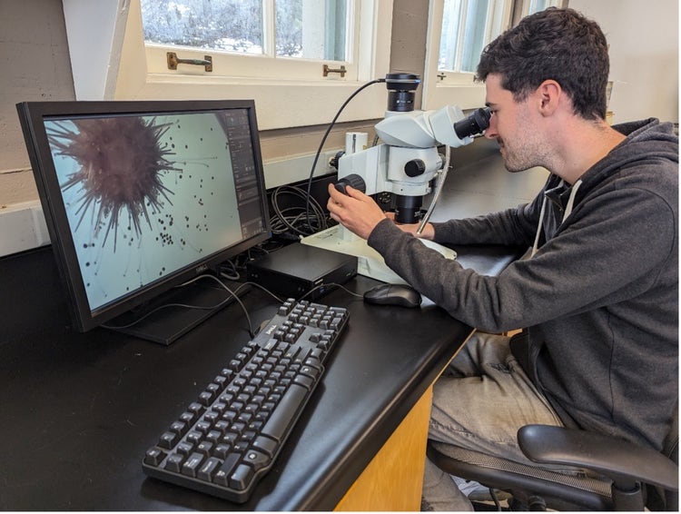 Sea urchin under the microscope