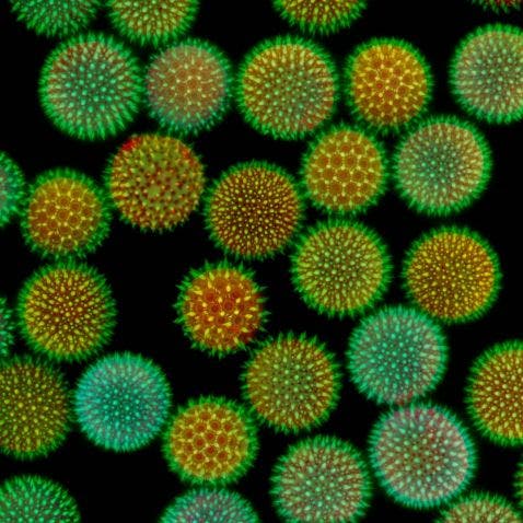 Flower pollen under the microscope