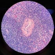 histology stained spleen slice