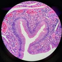 Lizard GI tract under a microscope