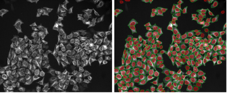 Deep learning cell segmentation