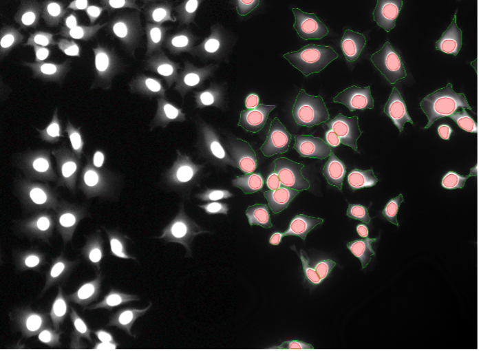 Deep learning image segmentation of Rat-1 cells