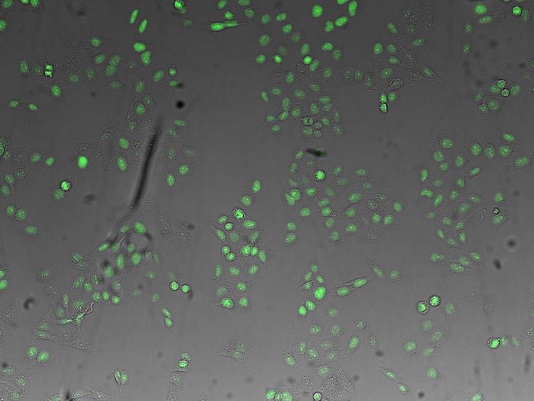 (green) fluorescence image of nuclei