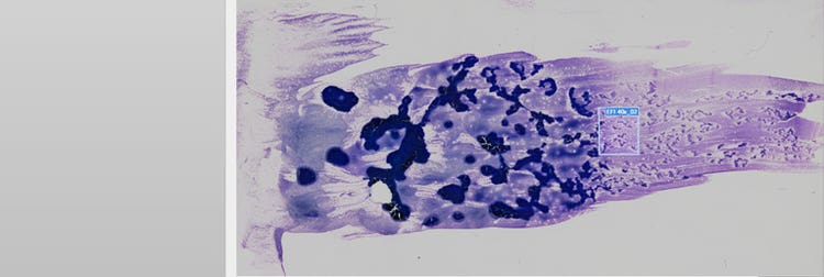 Whole slide imaging of a peripheral blood sample