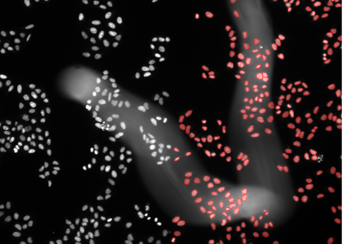 Deep learning image segmentation of HeLa cells