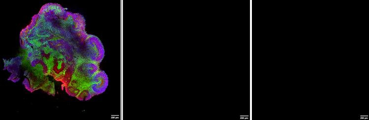 Multi-position imaging with an oil immersion lens, showing how imaging failed due to loss of oil contact.