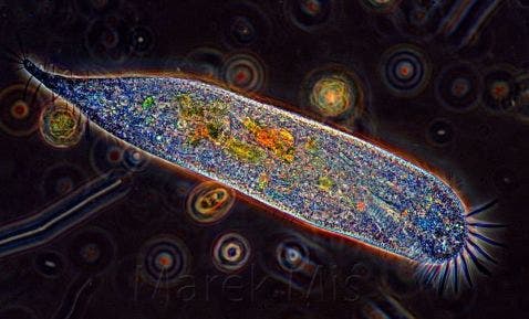 Ciliate under the microscope