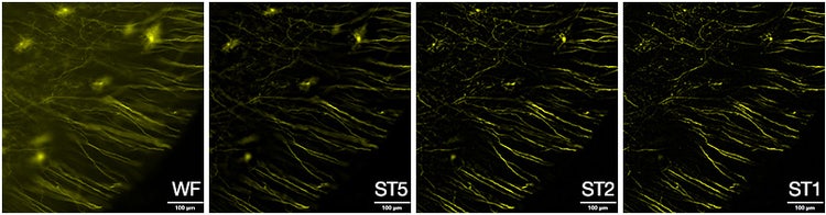 Figure 2. Mouse brain sample labeled with tdTomato, acquired at 20X.