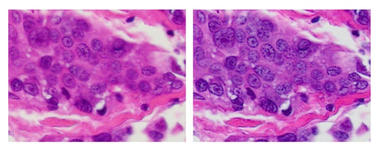 Noise reduction using image averaging in digital microscope cameras