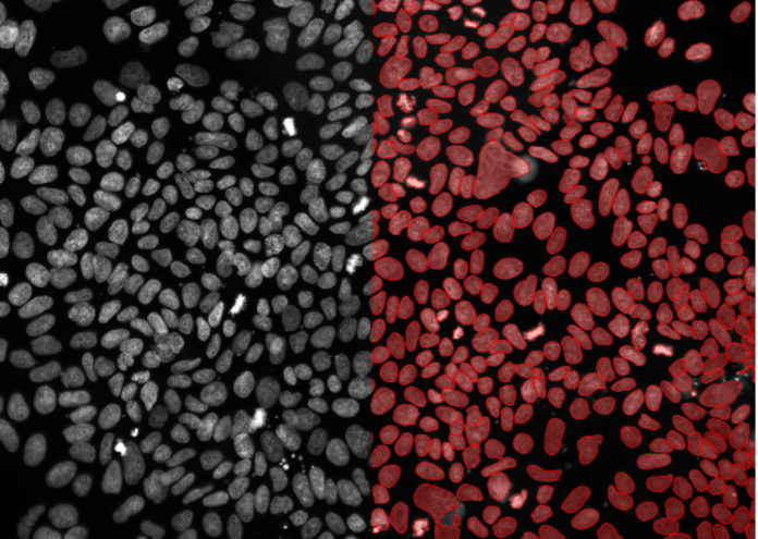 Deep learning image segmentation of U2OS cells