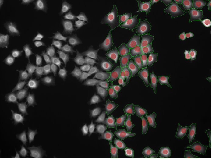 Deep learning image segmentation of Rat-1 cells