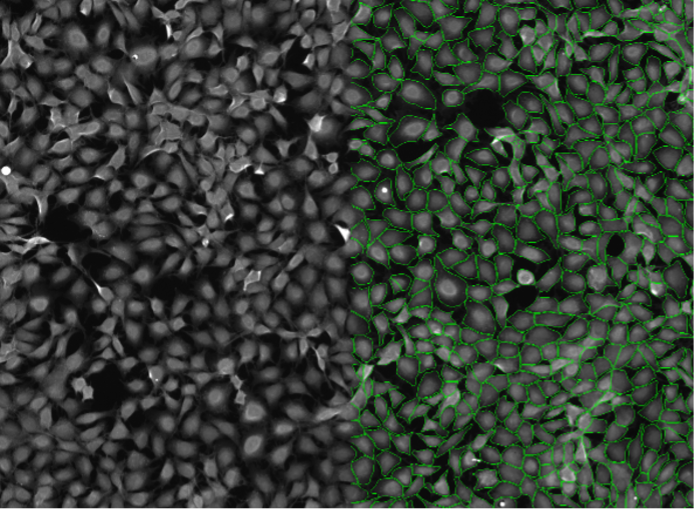 Deep learning image segmentation of Rat-1 cells