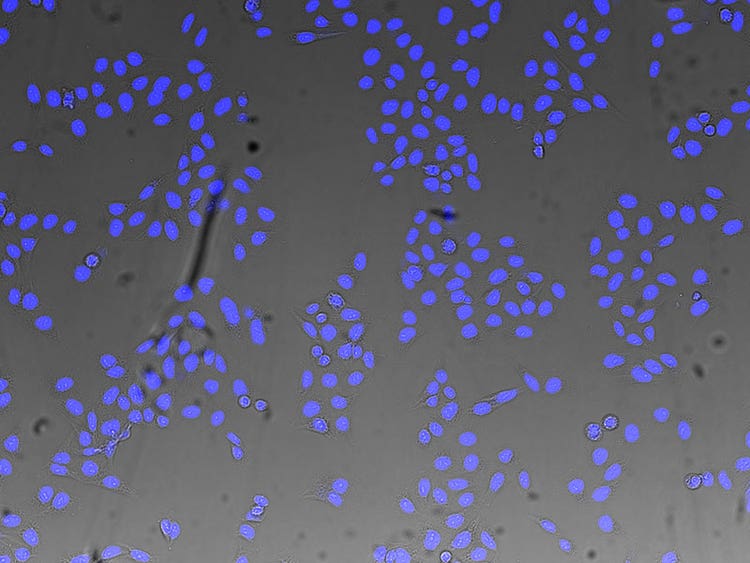 (blue) nuclei detected from brightfield image by TruAI technology