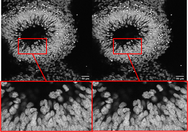 Dry objective image comparison before and after using the Evident silicone gel immersion objective.