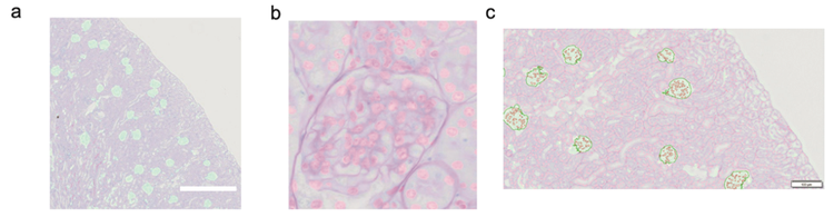 Figure 4. Applying the trained neural networks to a representative validation image. a. All glomeruli were identified in cyan b. All renal nuclei were identified in magenta. c. Identified glomerulus and nucleus were measured in the region of interest (ROI). The glomerular neural network provided an ROI for counting; the cellular neural network counted all nuclei within the ROI.