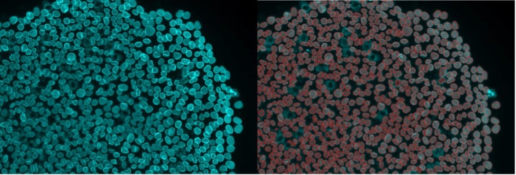 Instance segmentation of nuclear envelope straining
