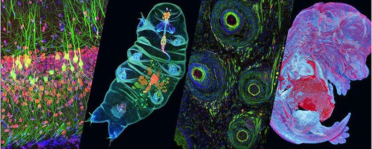 Microscope image contest winners