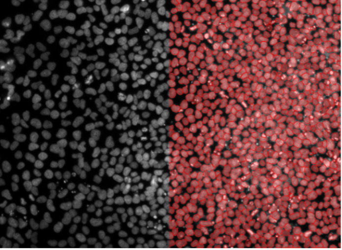 Deep learning image segmentation of pluripotenet stem cells