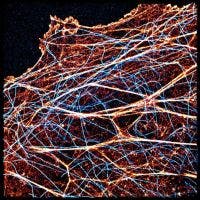 cytoskeleton closeup