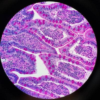 Dog intestine under a microscope