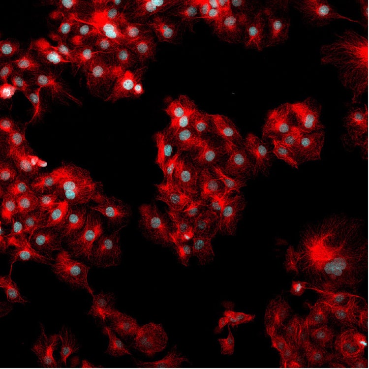 Fluorescence signal for 488 phalloidin marking the F-actin