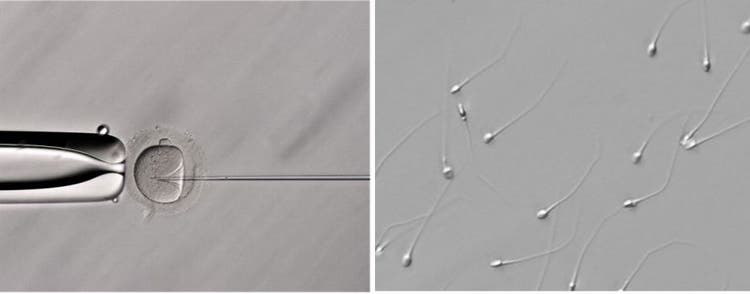 Hoffman modulation contrast images for assisted reproduction