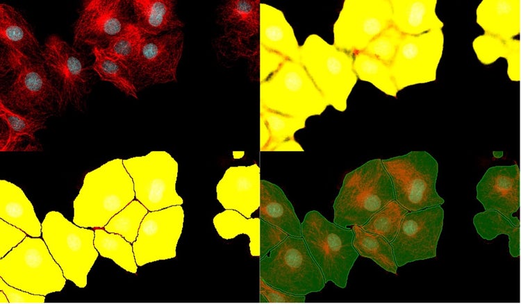 Cell separation results using standard segmentation vs. deep learning instance segmentation