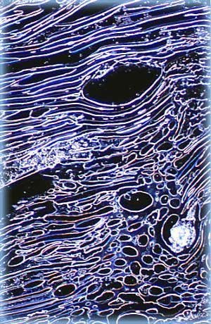 dark field imaging of liquid crystalline DNA