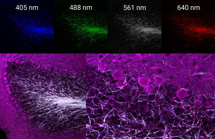 Multispectral reflectance confocal image of endogenous axon myelination