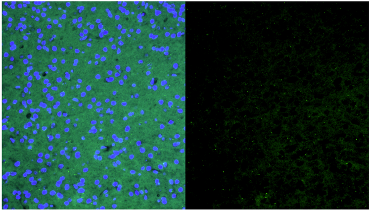 Fluorescence images of the stress group, showing the raw data and the data after signal adjustment.