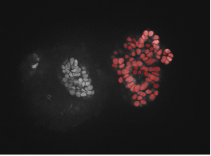 Deep learning image segmentation of kidney organoid cells