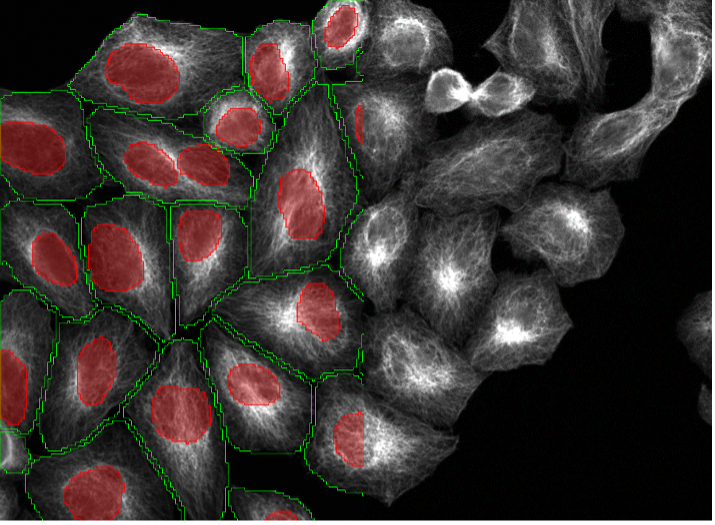 Deep learning cell segmentation of BPAE cells