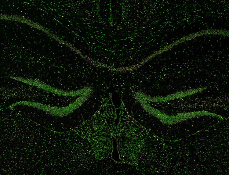 Using 3 distinct fluorescence channels (DAPI, Cy3, and Cy5), spatial transcriptomics reveals the presence of RNA molecules within a coronal mouse brain section.