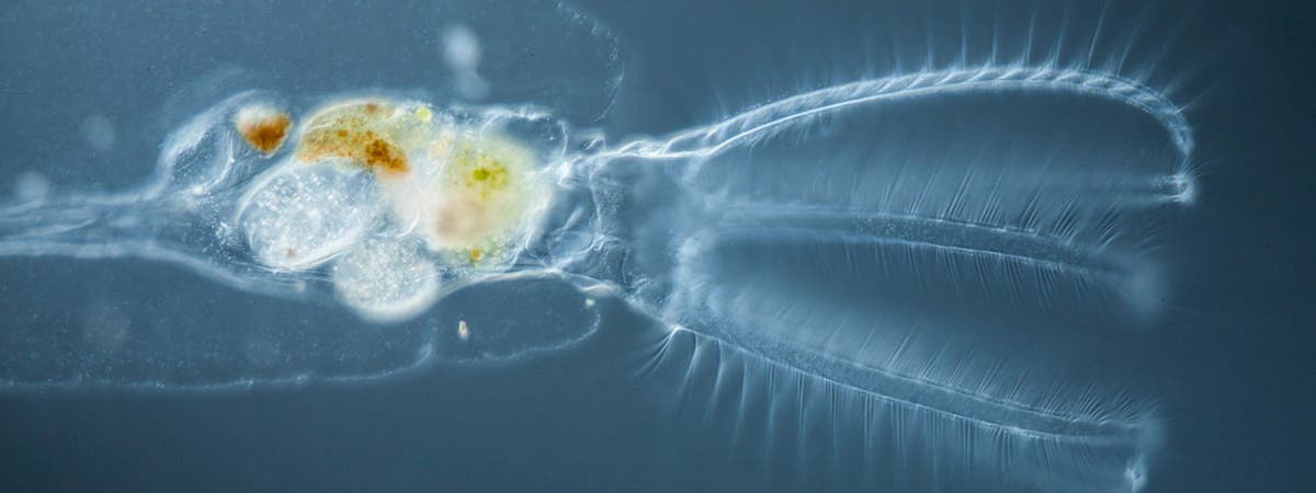 Avalon Finds Her Dream Microscope to Study Rotifers | Olympus LS