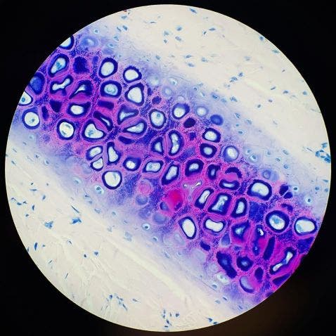 Acid fast bacteria stain