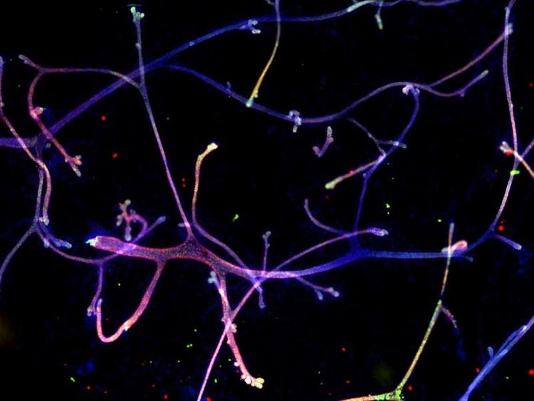 Application image of mouse mammary gland