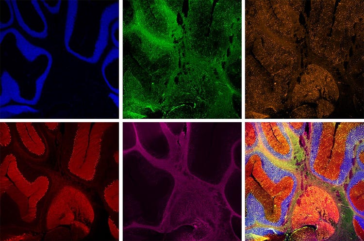 Rat cerebellum labeled by 5 fluorochromes