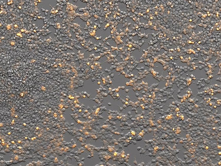 Gradient Contrast: See Your Sample in a New Light