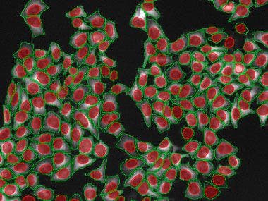 Instance Segmentation of Cells and Nuclei Made Simple Using Deep Learning