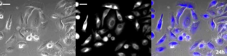 Long-term observation using an on-stage incubator (24 hours: phase contrast / luminescence / merge). Sample: HeLa cells expressing yellow-enhanced Nano-Lantern (35 mm glass bottom dish).