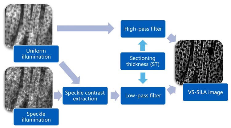 Figure 2. Diagram of VS-SILA processing.